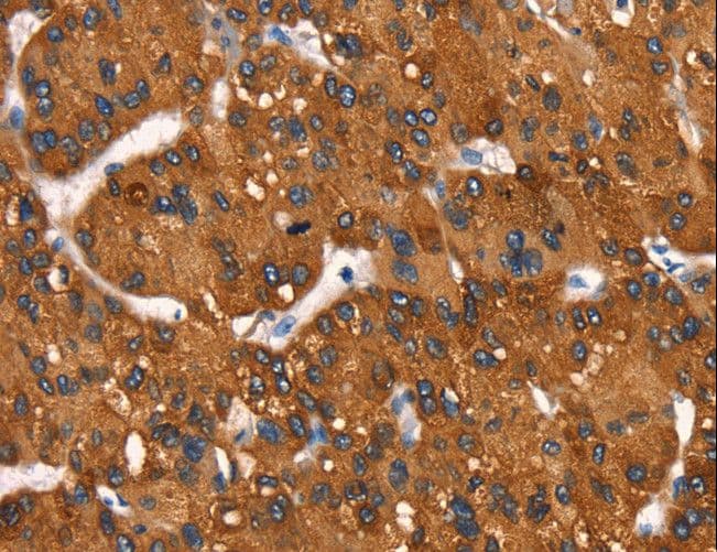 Polyclonal Rabbit anti-Human Cytochrome b Antibody (IHC)