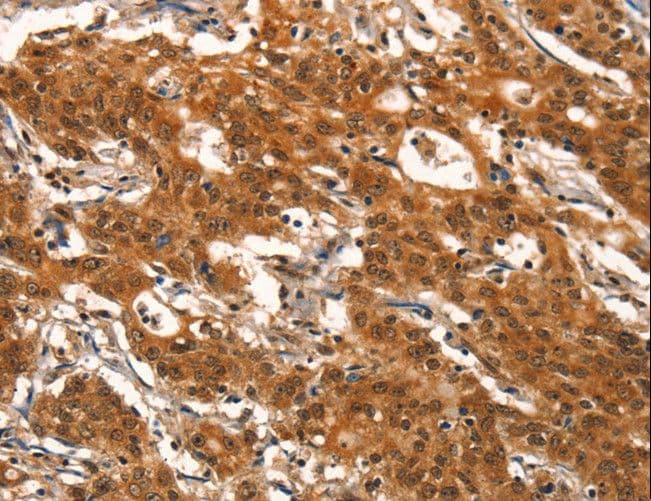 NUDR / DEAF1 Antibody