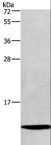 Polyclonal Rabbit anti-Human HINT / HINT1 Antibody (IHC, WB)