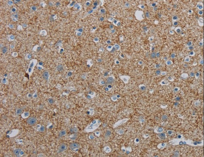 Polyclonal Rabbit anti-Human PGLYRP1 / PGRP Antibody (IHC)