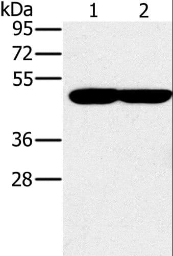 Polyclonal Rabbit anti-Human PPOX Antibody (IHC, WB)