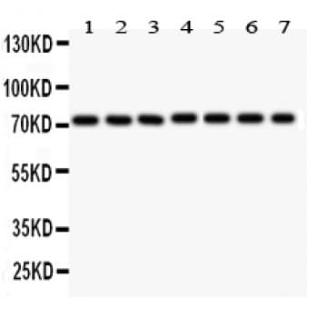 Polyclonal Rabbit anti-Human SDHA Antibody (aa44-380, WB)
