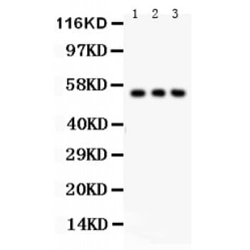 Polyclonal Rabbit anti-Human SLC2A2 / GLUT2 Antibody (aa486-514, IHC, WB)