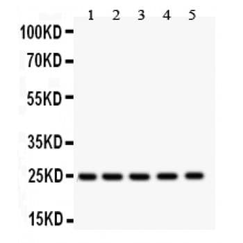 SOD2 / Mn SOD Antibody (aa192-222)