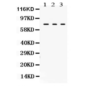 TGM2 / Transglutaminase 2 Antibody (aa7-34)