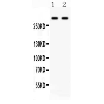 Polyclonal Rabbit anti-Human VCAN / Versican Antibody (aa65-92, IHC, WB)