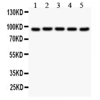 Polyclonal Rabbit anti-Human VIL1 / Villin Antibody (aa770-799, IHC, WB)