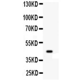 Polyclonal Rabbit anti-Human WNT2B Antibody (aa87-112, IHC, WB)