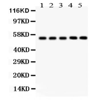 Polyclonal Rabbit anti-Human YBX1 / YB1 Antibody (aa293-320, IHC, WB)