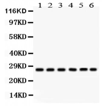 Polyclonal Rabbit anti-Human CIB1 / KIP Antibody (aa6-191, WB)