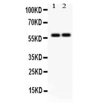 SCARB1 / SR-BI Antibody (aa478-509)
