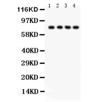 TNFRSF1B / TNFR2 Antibody (aa288-318)