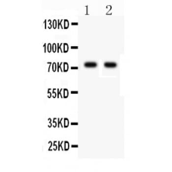 TNFRSF1B / TNFR2 Antibody (aa296-324)