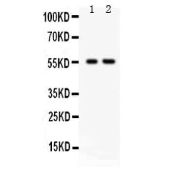 Polyclonal Rabbit anti-Human TRAF2 Antibody (aa308-339, IHC, WB)