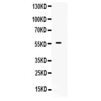Polyclonal Rabbit anti-Human ALK-6 / BMPR1B Antibody (aa14-184, IHC, WB)