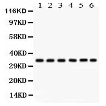 CDK1 / CDC2 Antibody (aa66-297)