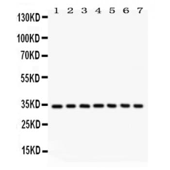 Polyclonal Rabbit anti-Human CDK2 Antibody (aa81-298, IHC, WB)