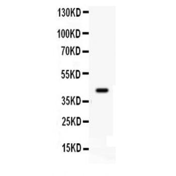 Polyclonal Rabbit anti-Human CDK9 Antibody (aa141-372, IHC, WB)