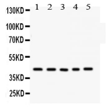 Polyclonal Rabbit anti-Human CYR61 Antibody (aa54-381, WB)