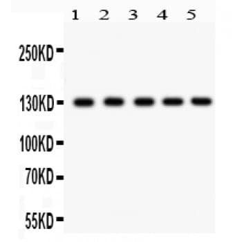 DAXX Antibody (aa56-345)