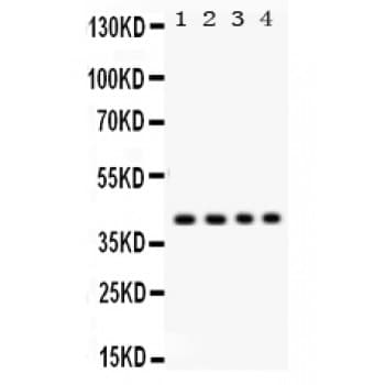 Polyclonal Rabbit anti-Human PARVA Antibody (aa155-185, IHC, WB)
