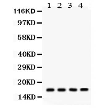 STMN1 / Stathmin / LAG Antibody (aa2-34)