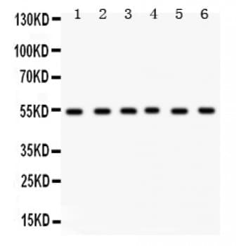 Polyclonal Rabbit anti-Human DLD / Diaphorase / E3 Antibody (aa300-509, IHC, WB)