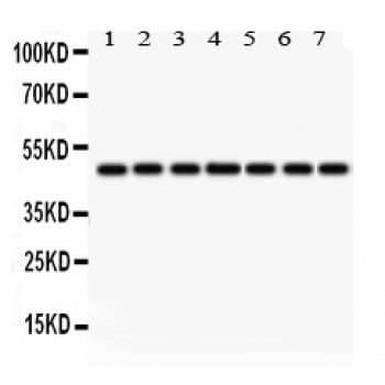 Polyclonal Rabbit anti-Human IDH1 / IDH Antibody (aa381-413, IHC, WB)