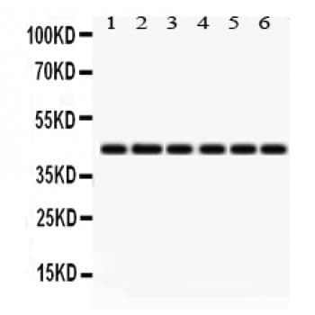 Polyclonal Rabbit anti-Human IDO1 / IDO Antibody (aa37-69, IHC, WB)
