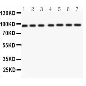 Polyclonal Rabbit anti-Human NBN / Nibrin Antibody (aa714-745, IHC, WB)