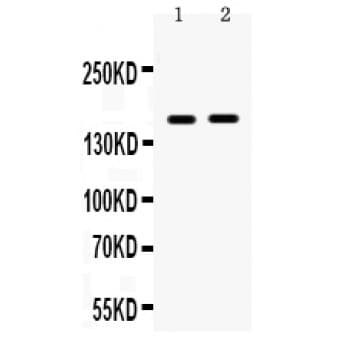 Polyclonal Rabbit anti-Human HDAC6 Antibody (aa137-169, WB)