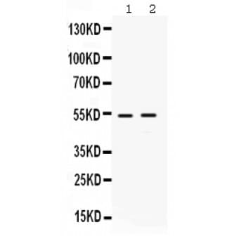 Polyclonal Rabbit anti-Human HSF4 Antibody (aa149-185, WB)