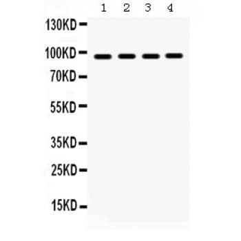 Polyclonal Rabbit anti-Human HSP90B1 / GP96 / GRP94 Antibody (aa43-221, WB)