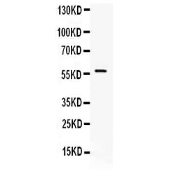 Polyclonal Rabbit anti-Human IKZF1 / IKAROS Antibody (aa428-459, IHC, WB)