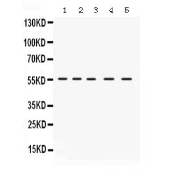 Polyclonal Rabbit anti-Human IRF5 Antibody (aa442-472, IHC, WB)