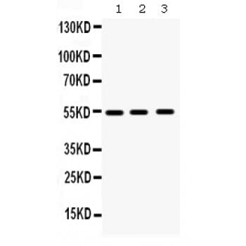 Polyclonal Rabbit anti-Human MMP10 Antibody (aa409-443, WB)