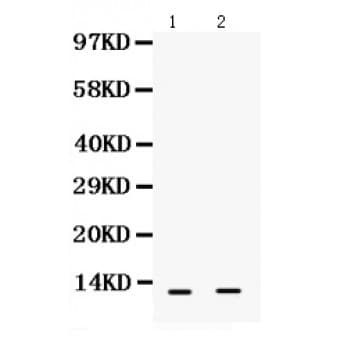 S100A6 / Calcyclin Antibody (aa1-90)