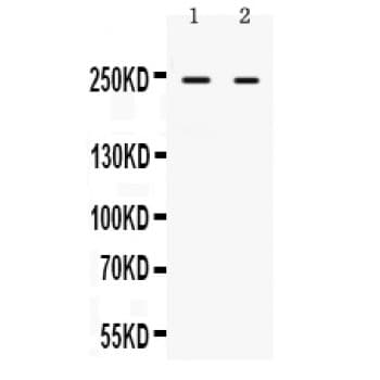 Polyclonal Rabbit anti-Human ARID1A / BAF250 Antibody (aa1021-1053, WB)