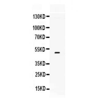 F3 / CD142 / Tissue factor Antibody (aa29-294)