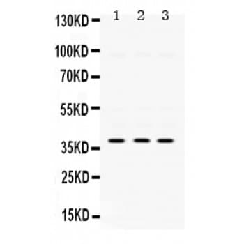 PRKAB1 / AMPK Beta 1 Antibody (aa32-68)
