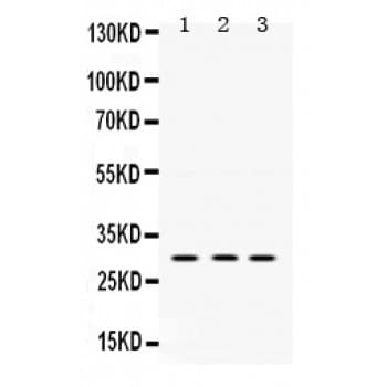 Polyclonal Rabbit anti-Human PRKAB2 / AMPK Beta 2 Antibody (aa56-89, IHC, WB)
