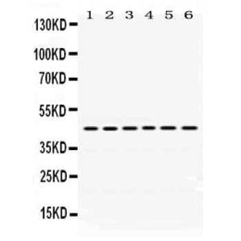ARC / Arg3.1 Antibody (aa332-366)