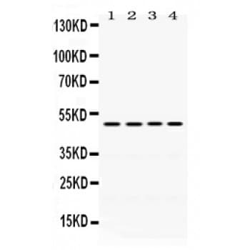 Polyclonal Rabbit anti-Human DDB2 Antibody (aa1-115, WB)