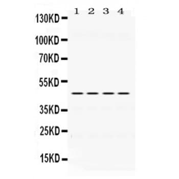 Polyclonal Rabbit anti-Human PAX6 Antibody (aa195-233, IHC, WB)