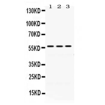 Polyclonal Rabbit anti-Human PDIA3 / ERp57 Antibody (aa471-505, IHC, WB)