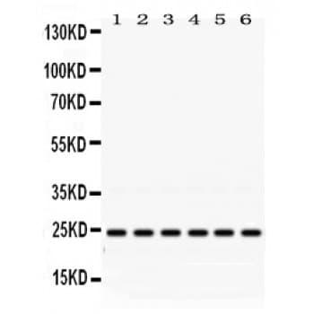 Polyclonal Rabbit anti-Human RAB5A / RAB5 Antibody (aa179-215, IHC, WB)