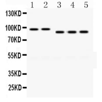 Polyclonal Rabbit anti-Human DLG4 / PSD95 Antibody (aa581-724, IHC, WB)