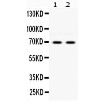 EIF2AK2 / PKR Antibody (aa511-551)
