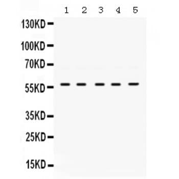 p56lck / LCK Antibody (aa468-506)