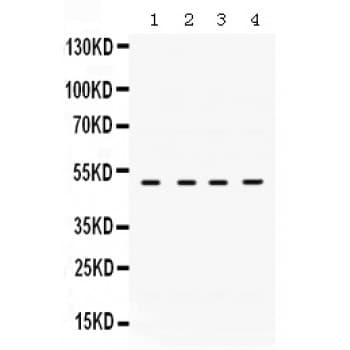 Polyclonal Rabbit anti-Human RRM2 Antibody (aa1-33, IHC, WB)